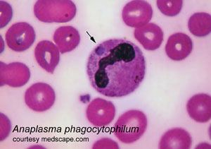 Anaplasma Phagocytophilum