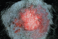 Пиотравматический дерматит наиболее часто ассоциирован с присутствием блох