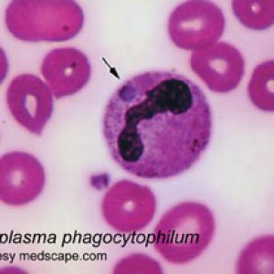 Anaplasma Phagocytophilum