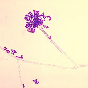 Aspergillus fumigatus